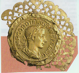 Diese gefasste Münze Kaiser Gordians beweist durch die Gegenüberstellung mit seiner Portraitbüste, dass antike Münzportraits durchaus nicht idealisiert sein müßen, sondern auch naturgetreue Abbildungen darstellen